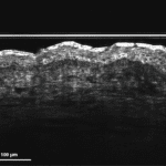 4 Aesthetic medicine adjust