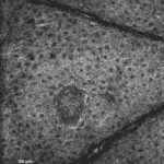 4 How to Read the OCT Images E scan Stratum granulosum