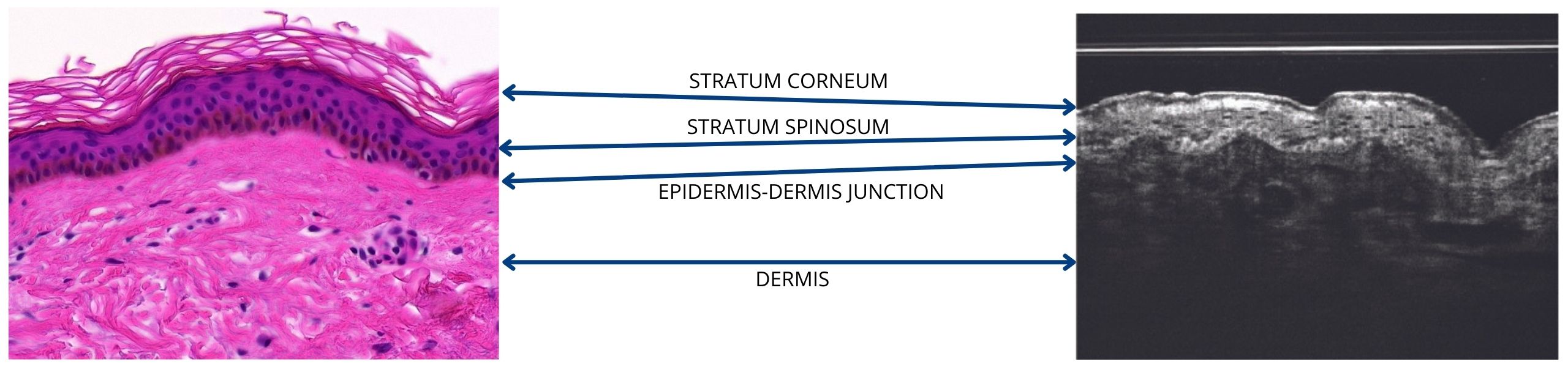 STRATUM CORNEUM v3 1