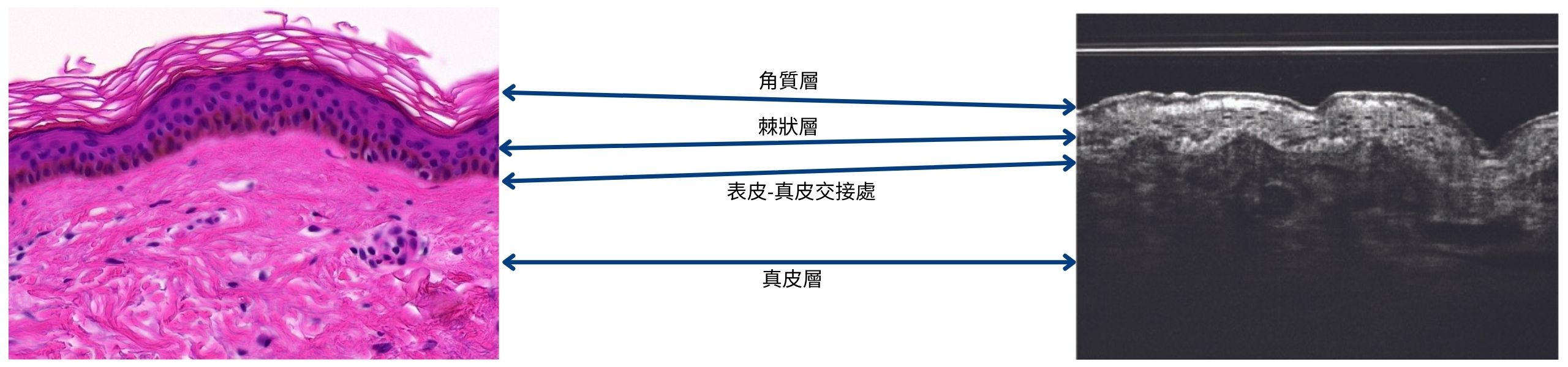 CH STRATUM CORNEUM v3